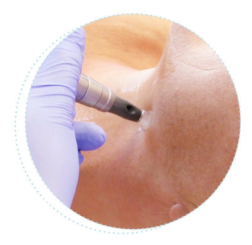 Dermatude Model Charge