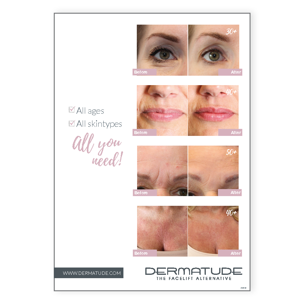 Poster Foam Board Before/After (42x29 cm) (Out of Stock)