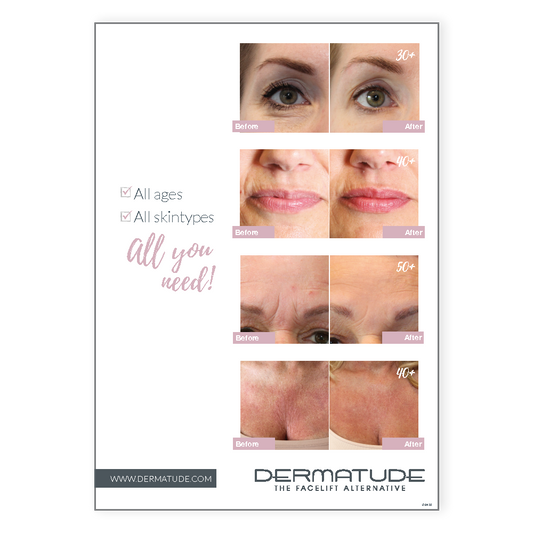 Poster Foam Board Before/After (42x29 cm) (Out of Stock)