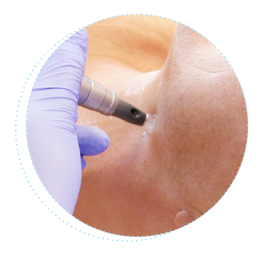 Dermatude Model Charge